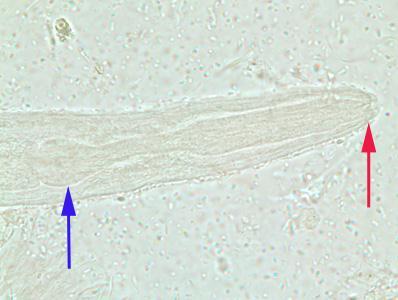 LAM Nº 75: Strongyloides stercoralis (larva rabditóide) Coloração: Carmin Material de preparação: fezes Características: