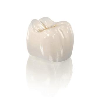 O que é um implante dentário?