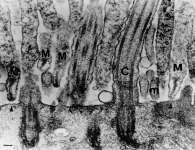 Características gerais Microorganismos pequenos, pleomórficos: 0,3 a 0,8 µm Não possuem parede celular Primeiramente identificados em bovinos com pleuro-pneumonia: PPLO (pleuropneumonia-like