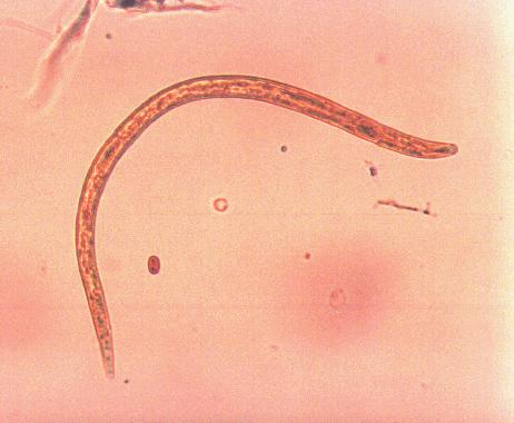 144 FIGURA 115 - Larva de Strongyloides stercoralis encontrado no sobrenadante proveniente do ensaio em coluna
