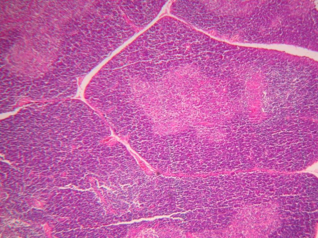 III-Timo Técnica: Hematoxilina-Eosina Observação com aumento total de 40x: Neste campo e neste aumento é possível observarse os lóbulos tímicos.