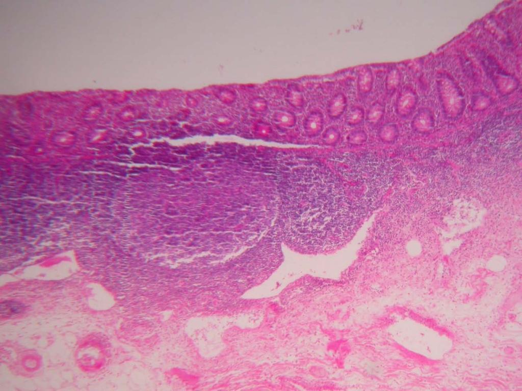 IV-Nódulo linfático e placas de Peyer no apêndice cecal Técnica: Hematoxilina-Eosina Observação com aumento total de 40x: Nesse campo microscópico observa-se a mucosa do apêndice cecal com a presença