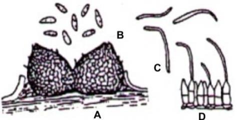 Phomopsis sojae Phomopsis sojae (SACC) - picnídios escuros, ostiolados, imersos no início, quase globosos; conidióforos simples; conídios hialinos, unicelulados, de dois tipos: ovóide para fusóide
