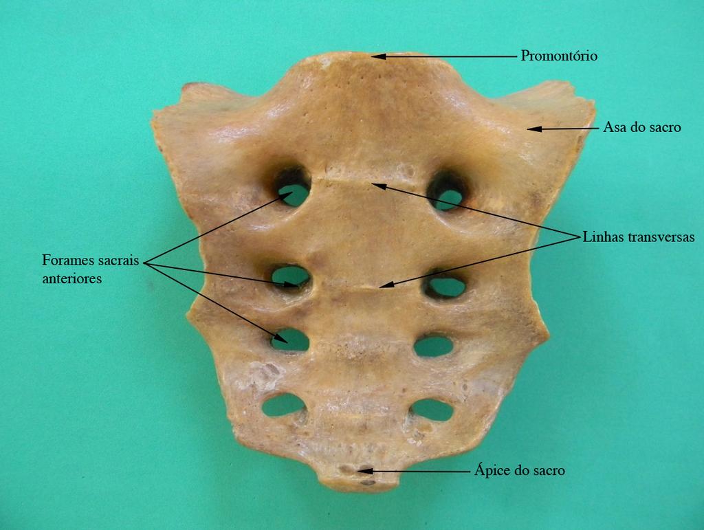 A quinta vértebra lombar (L5) apresenta o corpo vertebral inclinado inferiormente, anteriormente, com a finalidade de compor a articulação lombossacral.
