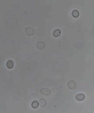 Eritrócitos normais geralmente são observados como células bicôncavas arredondadas com uma superfície
