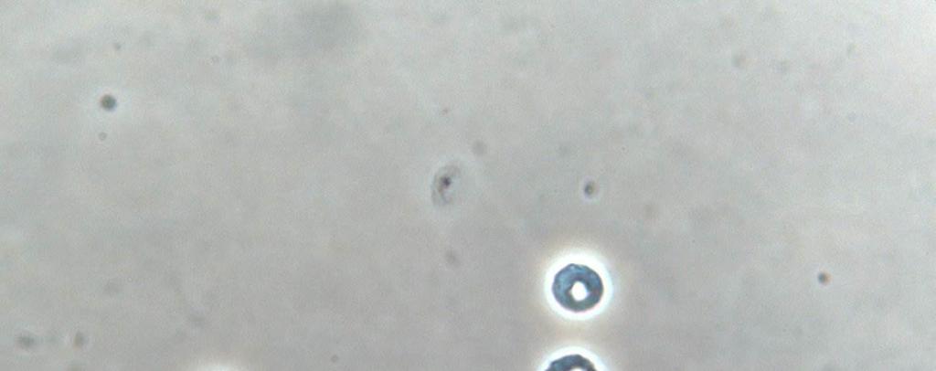 Eritrócitos crenados que são caracterizados por espículas regulares (Figura 2) são considerados