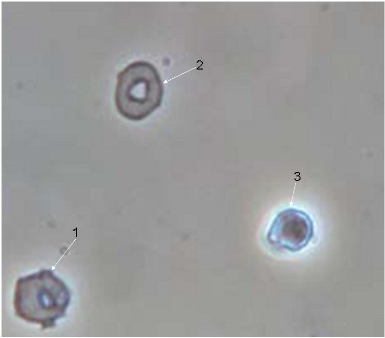 Acantócito (1); Blastoconídeo de levedura (2); Eritrócito normal (3); Acantócito (4); 3. Eritrócito normal (1); Blastoconídeo de levedura (2); Acantócito (3); Acantócito (4); 4.