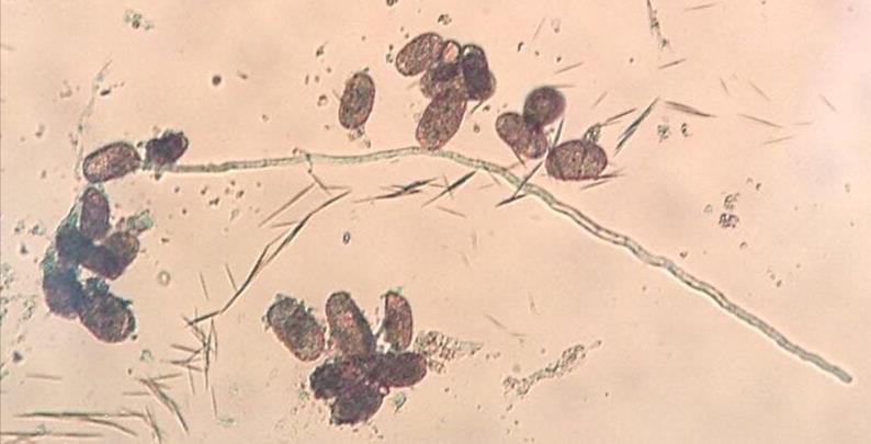 Figura 2. Lâmina com grãos de pólen em solução de sacarose 2% de Impatiens wallerana. Aumento de 400x, visto em microscopia ótica.