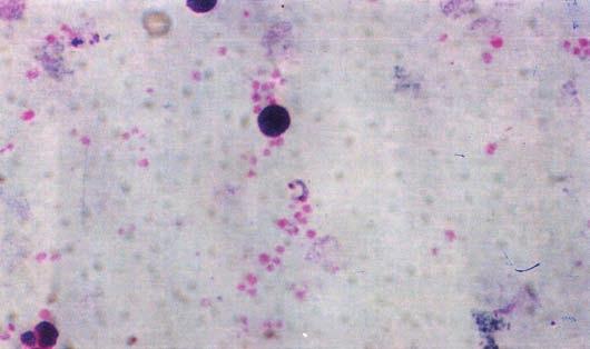 Manual de Diagnóstico Laboratorial da Malária Foto 29 Gota
