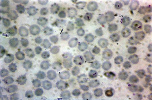 Manual de Diagnóstico Laboratorial da Malária Anexo B Imagens das diferentes espécies de
