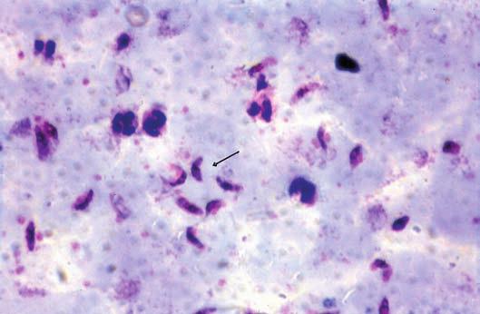 falciparum, apenas gametócitos (contaminada por bactérias) Foto 6 gota espessa