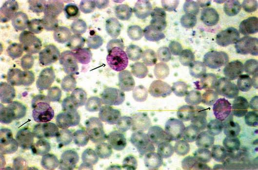 Manual de Diagnóstico Laboratorial da Malária Foto 9 esfregaço corado pelo