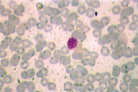 Manual de Diagnóstico Laboratorial da Malária Foto 13