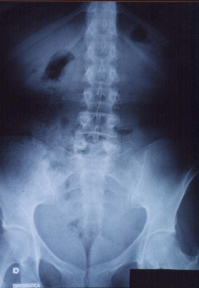 FIGURA 6 - Radiografias obtidas nos 4 o e 7
