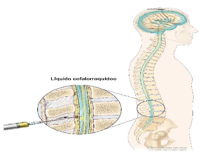 Líquido cefalorraquidiano (LCR) - Fármaco e