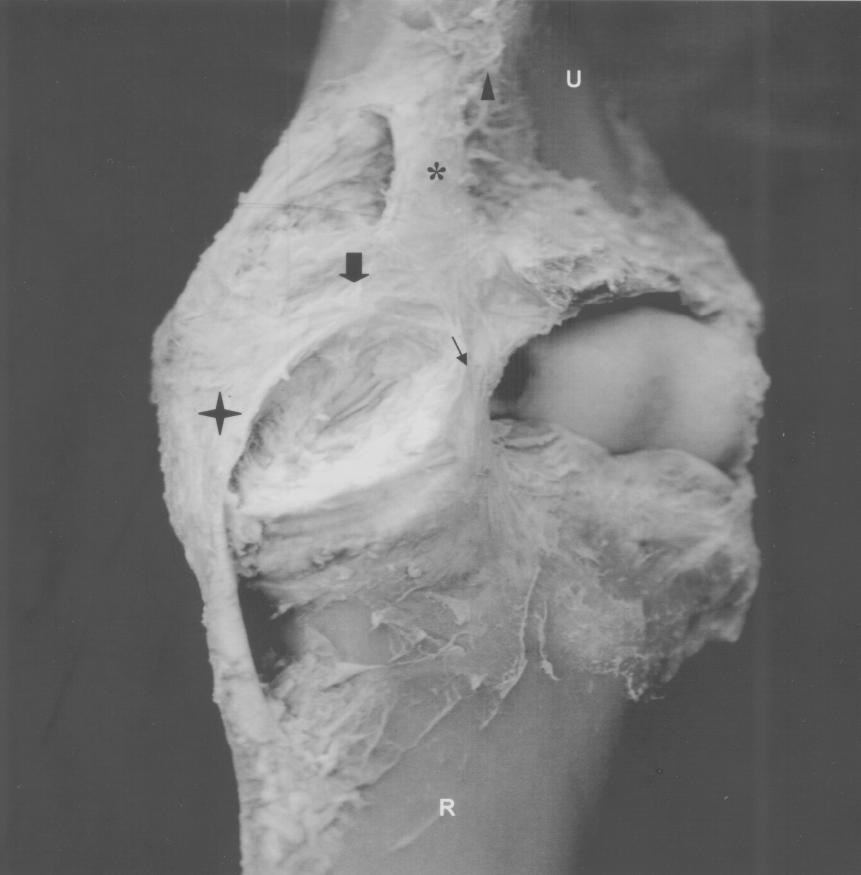 Características anatômicas e morfométricas do ligamento oblíquo do cotovelo de eqüinos. 1813 Figura 1 Vista cranial de preparação anatômica do cotovelo de eqüino,.