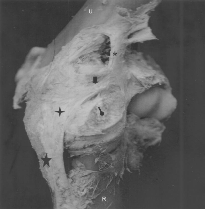 1814 Hernández-Tovar et al. Figura 2 Vista crânio-medial de preparação anatômica do cotovelo de eqüino.