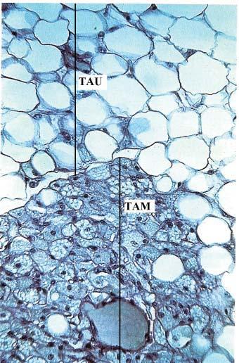 Histologia Básica Figura 4C: Fotomicrografia de tecido adiposo multilocular (TAM) e unilocular (TAU).