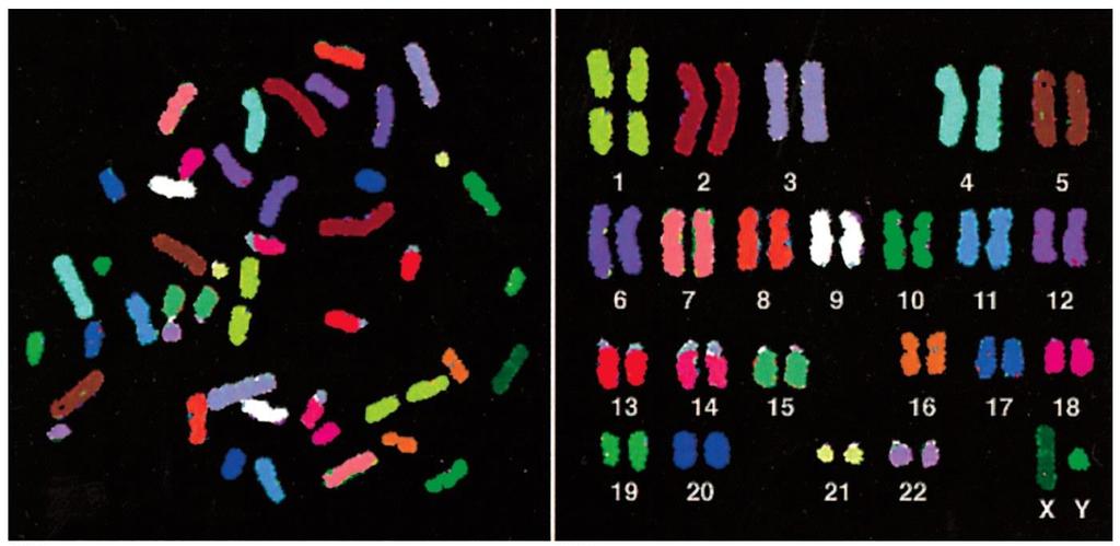 Visualização de cromossomos humanos Célula em