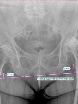 na imagem com o propósito de calcular as medições anatómicas.