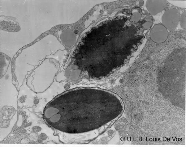Lisossomo Digestão intracelular Organelas circulares Degradação de partículas advindas do meio extra-celular, assim com a reciclagem de outras organelas e