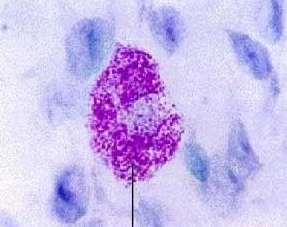 Mastócitos Elípticas Núcleo central Grânulos de histamina e