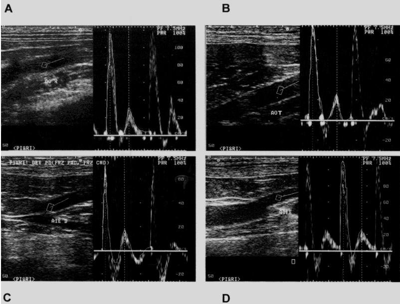 Ultra-sonografia da aorta abdominal e seus ramos em cães. 415 Figura 2 - A.