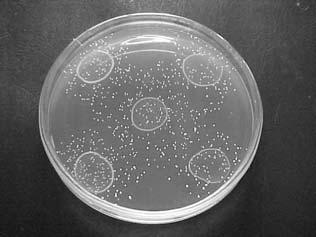 Método Biológico Teste de Beta-lactamase Resistente Sensível Resistência aos antimicrobianos em anaeróbios Resistência aos antimicrobianos em anaeróbios Resistência aumentando = área geográfica,