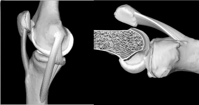 Articulação Tibiofemoral Fêmur distal + Tíbia