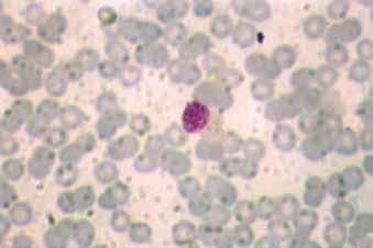 Manual de Diagnóstico Laboratorial da Malária FOTO 15