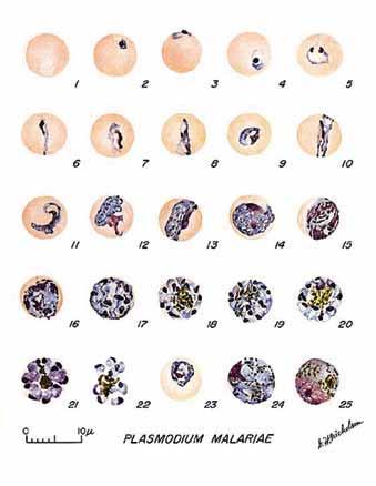 Secretaria de Vigilância em Saúde / MS FIGURA 7 PLASMODIUM