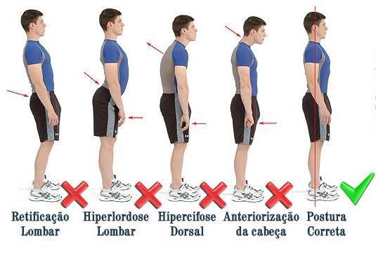 POSTURA CORPORAL Postura correta na posição em pé: linha vertical tirada do lóbulo da orelha passando pela articulação do ombro, pela linha mediana do tronco, pelo grande trocânter pelo joelho pouco