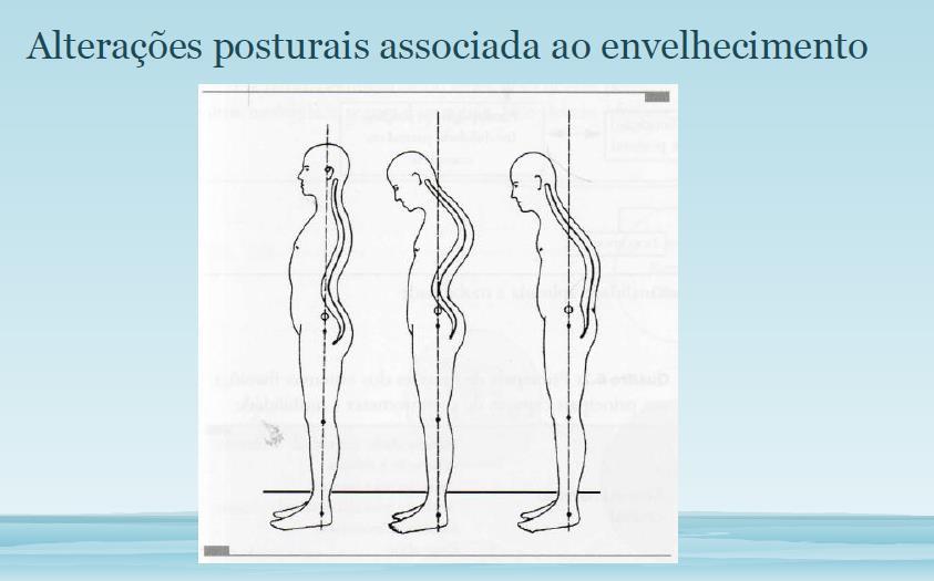 POSTURA