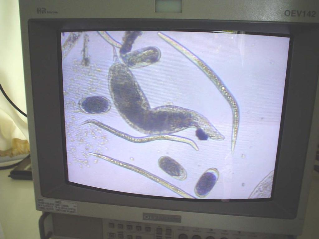 LABORATÓRIO DE NEMATOLOGIA AGRÍCOLA A AFOCAPI / COPLACANA tem a disposição de seus associados e cooperados o laboratório de análise nematológica, determinando a quantidade de nematóides presentes na