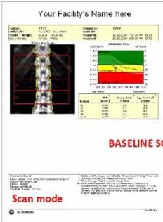 RESULTADOS NUMÉRICOS INDIVIDUAIS DE CADA VÉRTEBRA Diretriz elaborada 6 de 13 RELATÓRIO DE RESULTADO DXA* EQUIPAMENTO LUNAR RELATÓRIO AUXILIAR** EQUIPAMENTO LUNAR XXXXXXXXXXXXXXXXXXXXXXXXXXXXXX