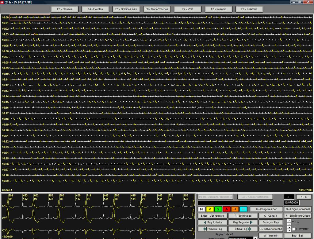 Holter Digital