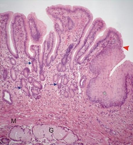 Transição esôfago-estômago (Cardia) glândulas da mucosa Ponto de transição (esôfago: epitélio