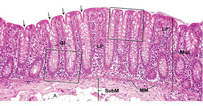 Intestino Grosso (colon) Mucosa (Muc), lâmina própria (LP) Glândulas