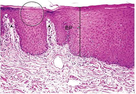 Transição pele - mucosa oral Mucosa: camada constituída pelo epitélio+lâmina própria (tec.