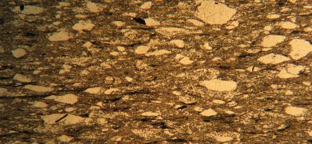 típica de ZTP. Microscopicamente, textura granolepidoblástica com foliação anastomosada, aspecto bem deformado. Matriz de granulação fina com porfiroclastos de quartzo de granulação grossa.