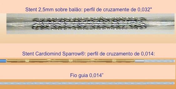 Stent 2,5 mm sobre balão: perfil de cruzamento de 0,032 Stent Cardiomind Sparrow@: perfil de cruzamento de 0,014: Fio-guia 0,014 Figura 1 - Comprovação do baixo perfil do sistema de implantação de