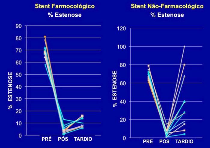 Tabela 4 - Variáveis da angiografia coronária quantitativa intrastent aos oito meses Variáveis SF(n = 12) SNF(n = 12) p IC (95%) DRI (mm),8 meses média (DP) 2,44 (0,19) 2,24 (0,42) 0,153 ( 0,08;