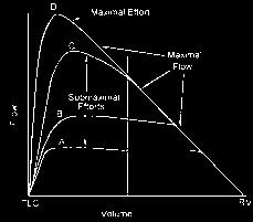 Fluxo x Volume Volume x Tempo ESPIROMETRIA CRITÉRIOS ACEITABILIDADE Bom Início do Esforço Início Abrupto, sem hesitação Pico Fluxo Nítido