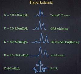 renal crônica apresentam hipocalemia) atenção com