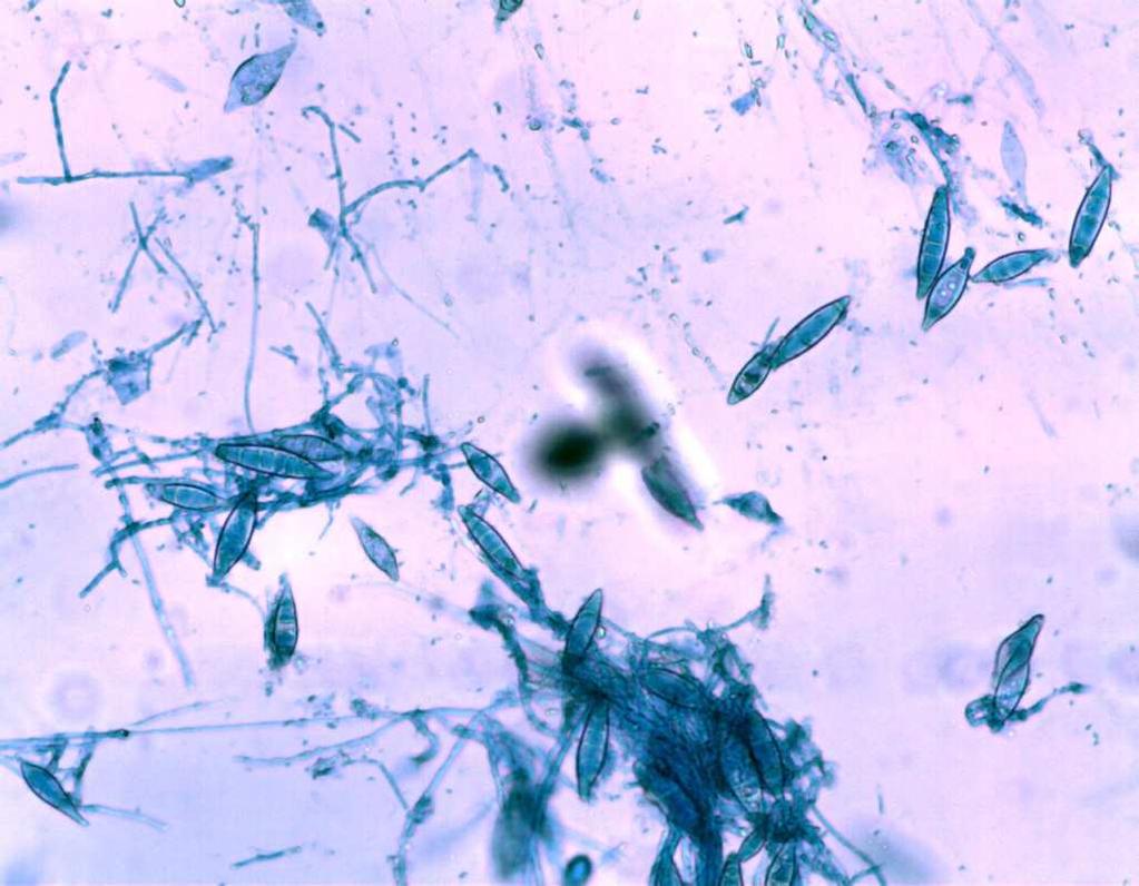 FIGURA 1: Imagem microscópica de macroconídeos de Microsporum canis (objetiva 40x), após subcultivo em ágar batata e incubação por 15 dias à 25-30 ºC. Fonte: Arquivo pessoal, 2010.