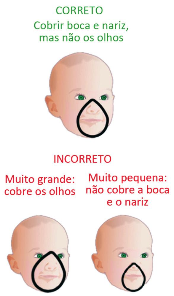 reanimação neonatal 65 Para os RNs com IG <34 semanas que necessitem de VPP, esta deve ser iniciada com FiO 2 de 30%, fornecida através de um blender.