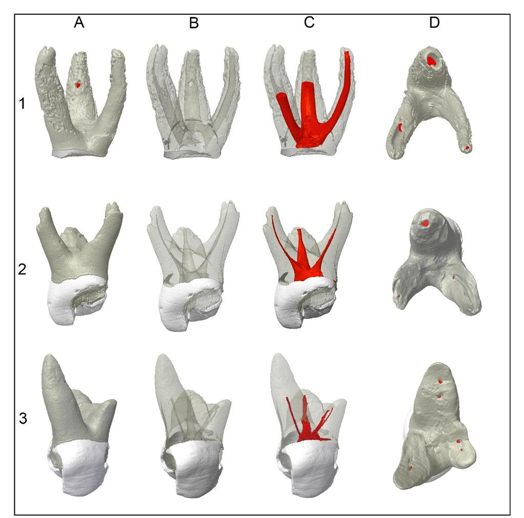 48 Resultados Figura 12. Modelos tridimensionais evidenciando a anatomia interna dos primeiros molares decíduos superiores.