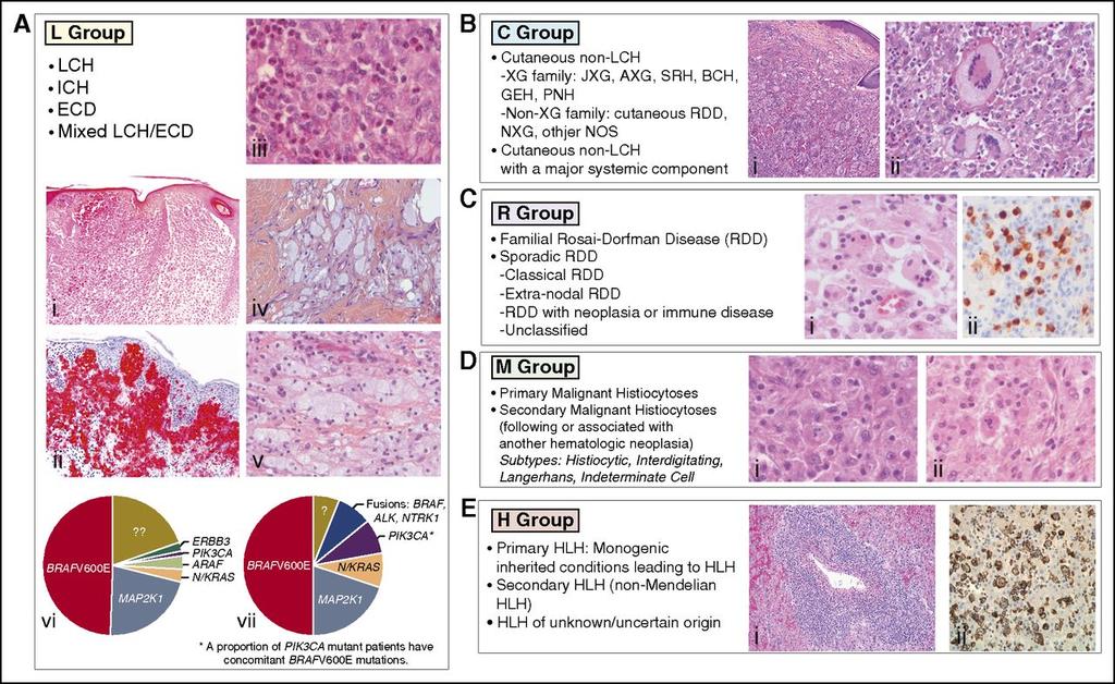 Histology and somatic mutations of histiocytoses of group L, C, R, M, and H.