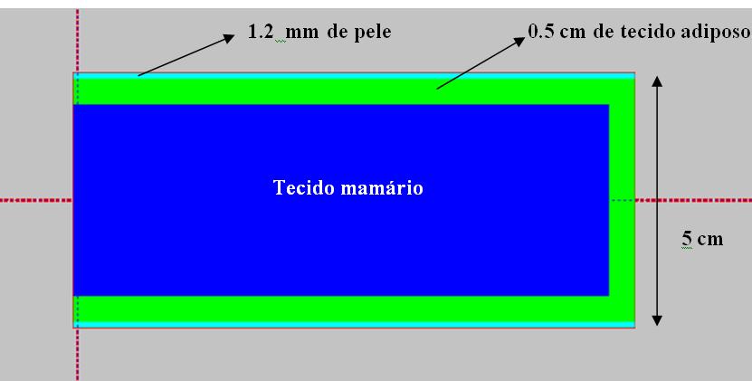 Para se obter o kerma no ar com a utilização dos detectores F5, foram empregados fatores de conversão da ICRP51[31].