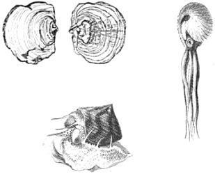 a) O ciclo do Schistosoma mansoni, acima esquematizado, está dividido em três fases. Em qual das três fases ocorre a infestação do homem? Explique como ocorre a infestação.